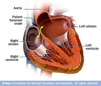 Fetal Circulation From the Right Atrium some blood will move into the Right Ventricle