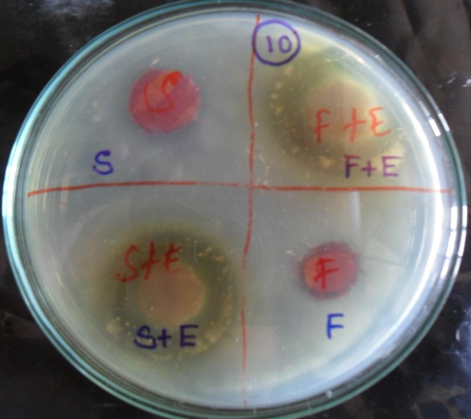 12: with Escherchia coli Strains Table 1: Result Showing Zone of