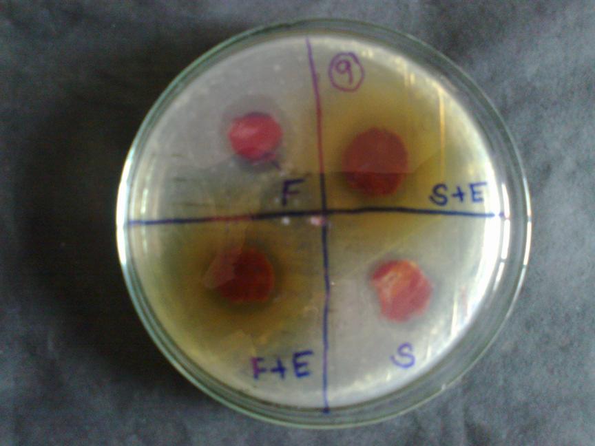 Solution) Figure 13: With Staphylococcus aureus Figure 15: With