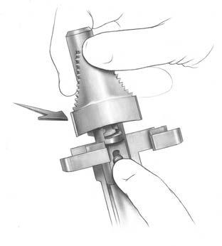25 NexGen Intramedullary Instrumentation Surgical Technique Figure 50 Figure 52 Figure 51 Figure 53 Step Nine: Finish the Tibia