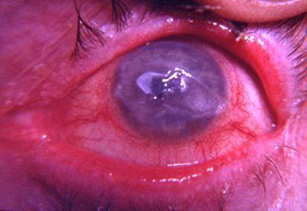 Multi-System Trauma Treat life threatening injuries first Consider screening eye exam during D Ice Reassess, reassess