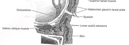 Anatomy Eye Lid Lacerations  margin Near medial