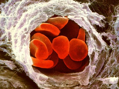 Red Blood Cells (RBC) AKA.