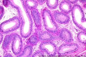 HISTOLOGY OF THE MALE REPRODUCTIVE SYSTEM Exercise 5: Under low power of the microscope, examine slide #12. This shows a portion of a testis.
