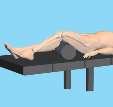 Surgical Operation 1. Position patient Position the patient in the lateral decubitus or supine position on a fracture table or radiolucent operating table.