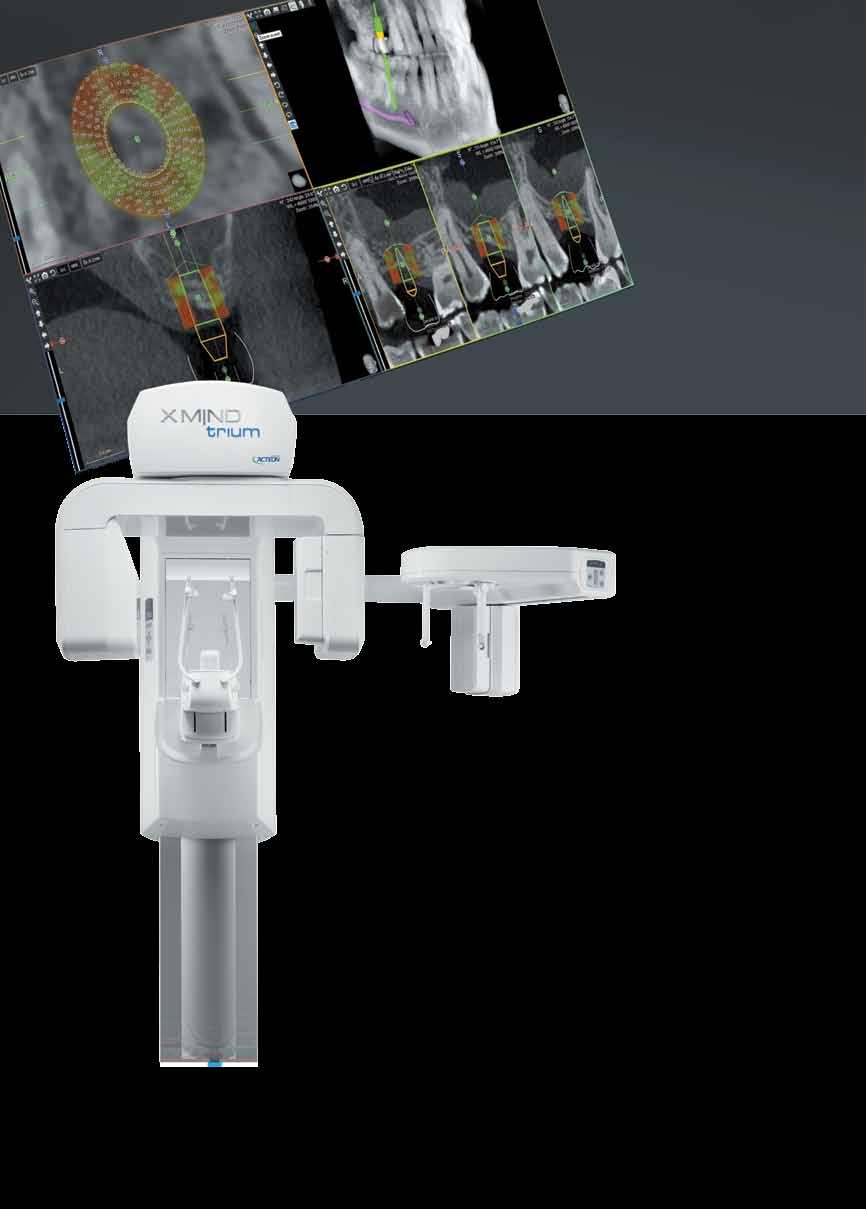 TECHNICAL SPECIFICATIONS 1168 1501 1978 1237 1551-2351 Ø 1090 PANORAMIC CBCT CEPHALOMETRIC X-RAY SOURCE Tube type High frequency DC generator 2.8 mmal / 85 kv 7.0 mmal / 90 kv 2.