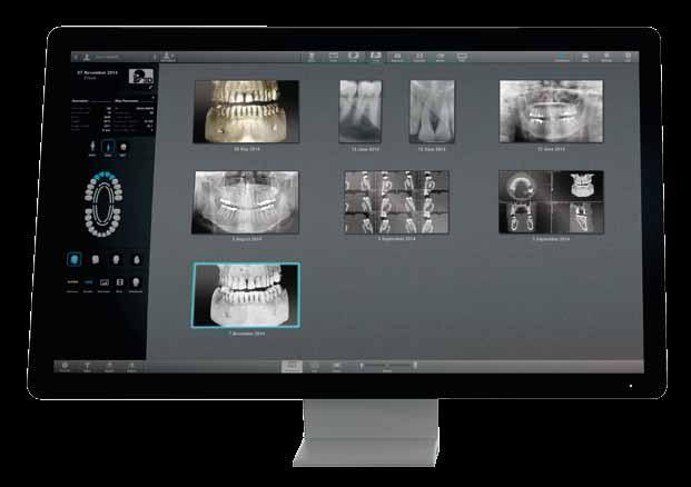 COMPREHENSIVE SOFTWARE The ACTEON Imaging Suite software offers intuitive navigation with the mouse and advanced functionality.