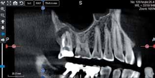 significantly to the accuracy of endodontic analyses, such as: The determination of the