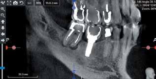 diagnose infectious diseases - Examining maxillofacial fractures - Determining the