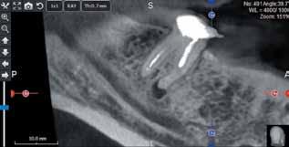 Detecting dental anomalies - Helping to diagnose temporomandibular joint disorders -