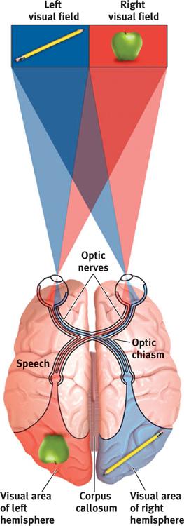 Split- Brain Epilepsy, seizures and the corpus callosum ReducFon in epilepfc