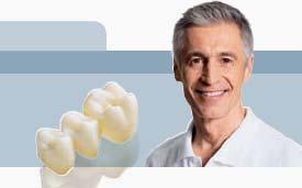 Lava All Zirconia Your tooth-colored, biocompatible solution for challenging clinical cases Replace