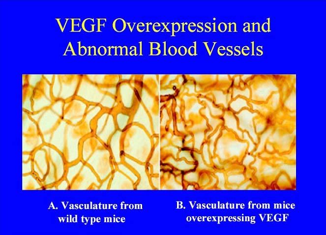 VEGF Overexpression and Abnormal blood