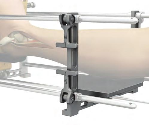 Section 3: Alignment and External Fixation 3 Adjust Calf Block Supports Unlock the four lever fasteners on the U-frame component on the proximal end of the Alignment Stand assembly and slide