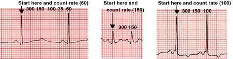 Systematic ECG