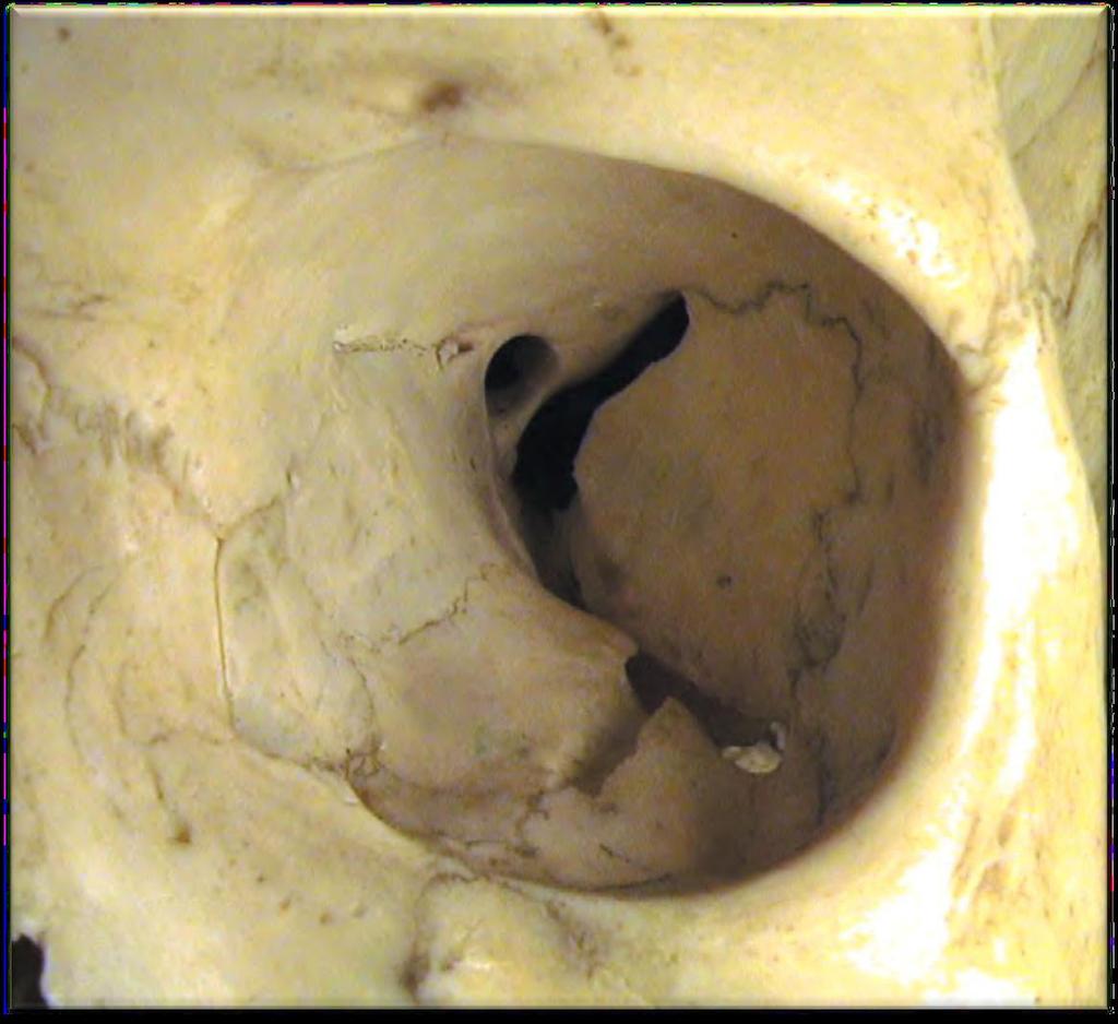 Optic canal Posterior ethmoidal foramen Superior orbital fissure Anterior ethmoidal