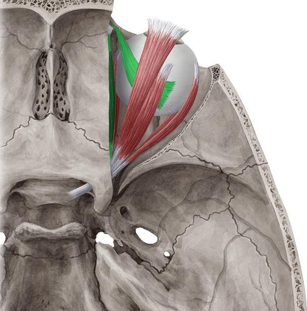 5-Superior oblique Origin: Posterior part of the roof Insertion: Passes through pulley (trochlea) and is attached to lateral posterior half of eyeball