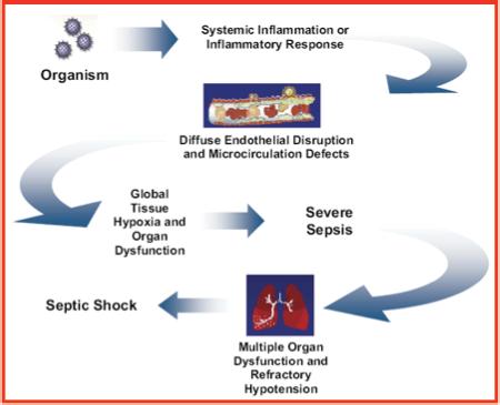 From Infection to Septic Shock Definition SIRS Sepsis Severe Sepsis sepsis-induced hypotension sepsis-induced hypoperfusion Septic shock Nguyen HB, et al.