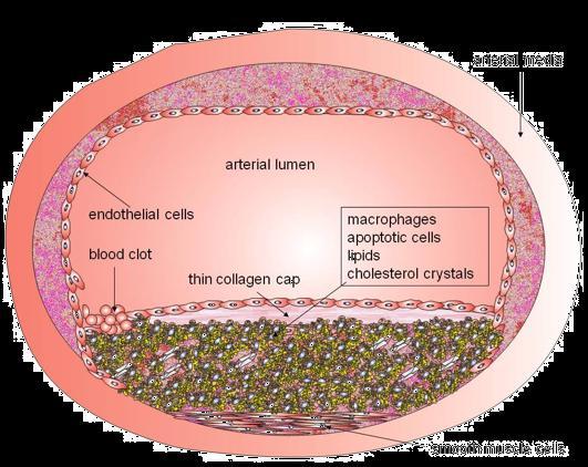Cholesterol crystals activate the caspase-1-activating