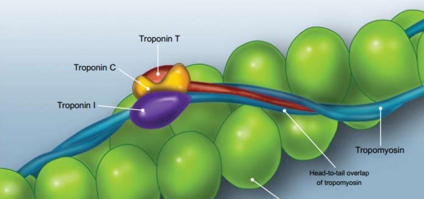 Troponin as an index of