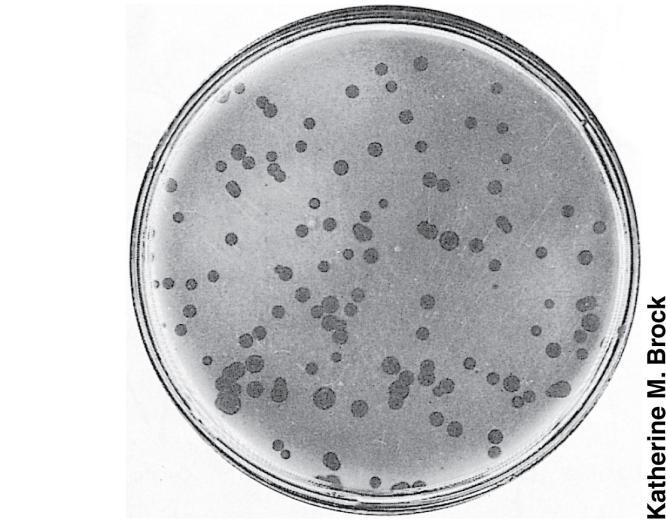Figure 14.35 Cytophaga hutchinsonii colonies on a cellulose agar plate Cellulose digestion Areas where cellulose has been hydrolyzed are more translucent 14.