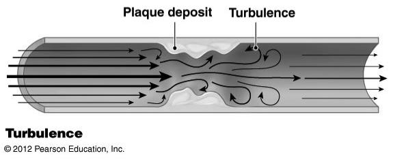 Turbulence Affects Blood Flow! Turbulence increases resistance to blood flow!