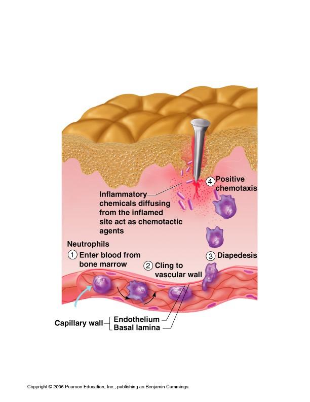 Inflammatory Response triggered when tissues are injured redness, heat, swelling, pain 1.