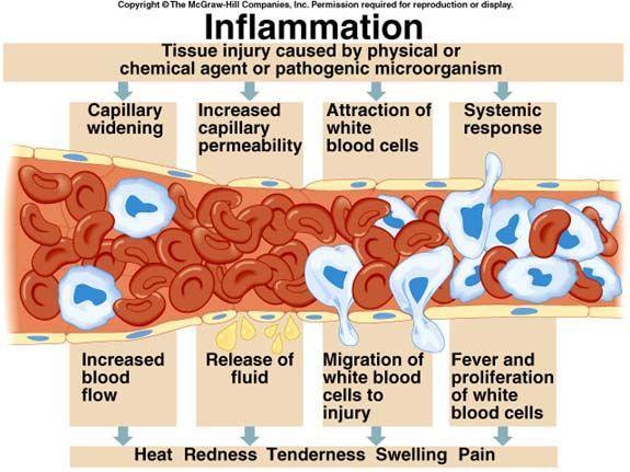 Inflammation When there is tissue injury, the inflammatory response begins. Damaged cells release histamine. Histamine causes vasodilation near the injury.