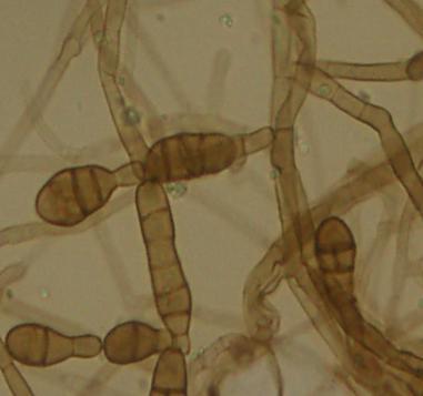 : P. spinulosum, P. citrinum Acremoniium spp. ( A. potronii, A.