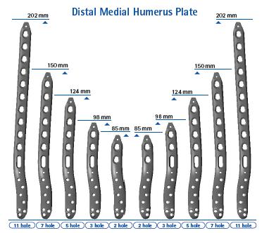5 Preoperative Planning Distal Medial Humerus Plate Plate position: medial column,