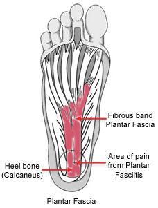 Anatomy The plantar fascia is a long, thin ligament that lies directly beneath the skin on the bottom of your foot. It connects the heel to the front of your foot, and supports the arch of your foot.