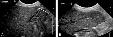 Ultrasound l Smooth margins, not rounded l Homogeneous, uniform texture, medium level echogenicity (spleen>liver>kidney) l Radiographs may be superior for size assessment l Presence of nodules,