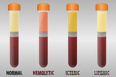 Blood Work l Hepatocellular leakage/necrosis l ALT, AST l Cholestasis l ALP, GGT, bilirubin, bile acids l Decreased hepatic function l