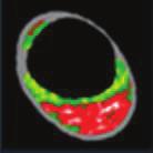 Automated coronary plaque characterisation with