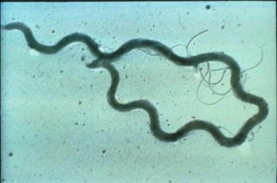 Syphilis - Treponema pallidum Staging of