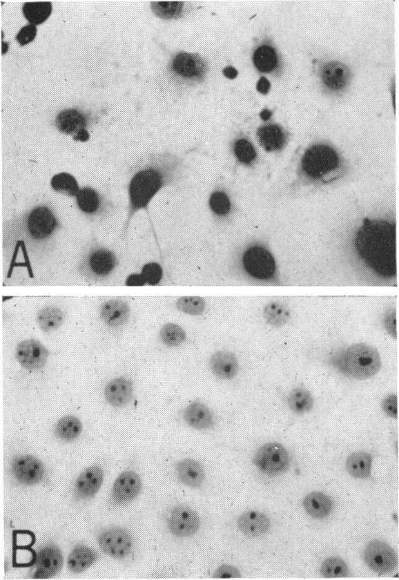 VOL. 91, 1966 CULTURES WITH RUBELLA INFECTION 437 7.p. 6 a ỊM lr & '4& 49P jj*; FIG. 1. Morphological characteristics of the two cultures on the 2nd day after seeding. (A) RAL cells.