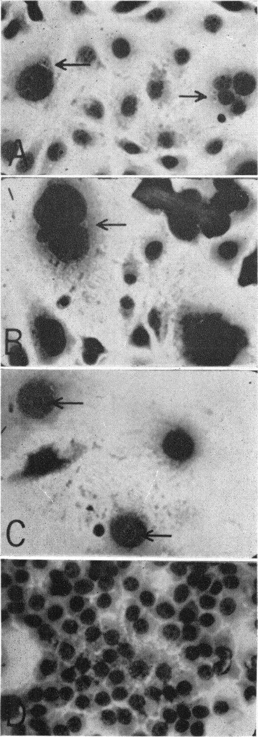 Figure 1 compares the two lines at higher magnification. In the RAL culture (Fig. la) small rounded cells (with no apparent cytoplasm) are evident the 2nd day after seeding.