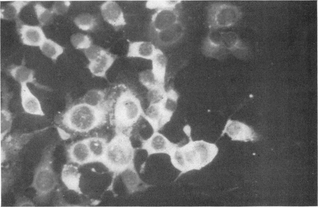 VOL. 91, 1966 CULTURES WITH RUBELLA INFECTION 439 FIG. 6. Culture ofral cells 5 days after seeding. Indirect immunofluoresceent technique (1: 8 dilution ofhuman convalescent serum). X 180. FIG. 7.