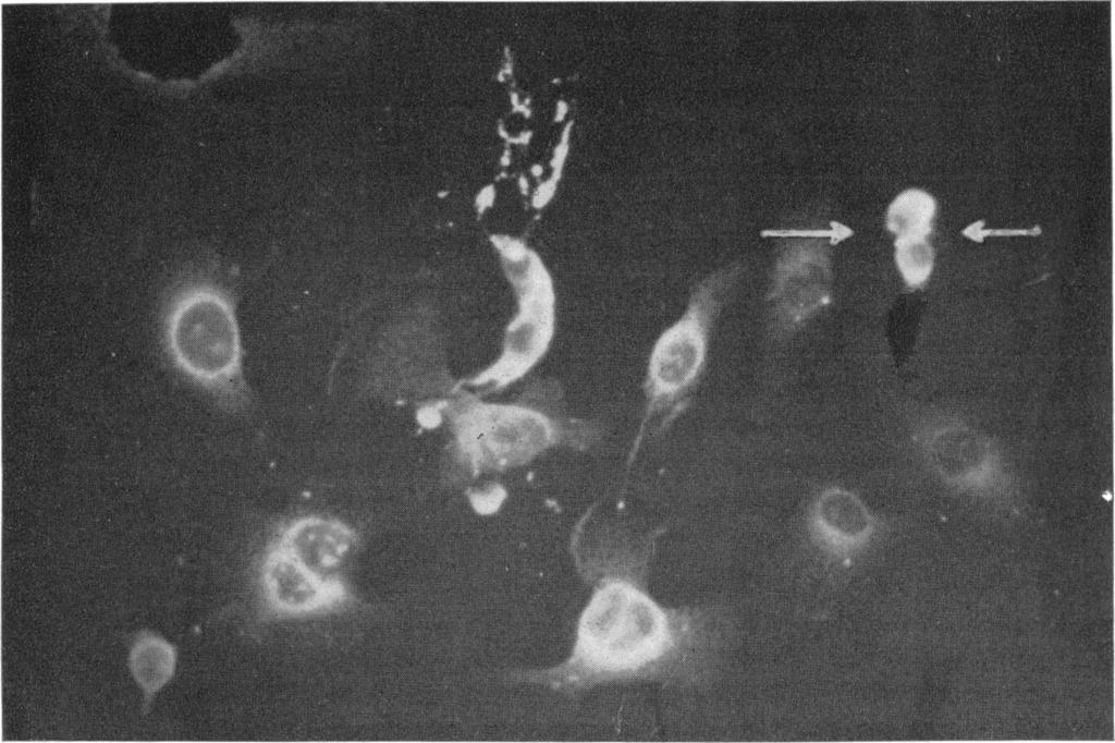 Arrows indicate a c ell unidergoinig mitosis with intense peripheral fluorescence. X 180. neutralizing 'y-globulin.