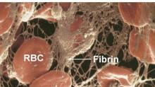 Coagulation: blood clotting Convert fibrinogen to fibrin Fibrinogen: soluble plasma protein Fibrin: