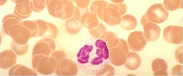 White Blood Cells (Leukocytes) Combat