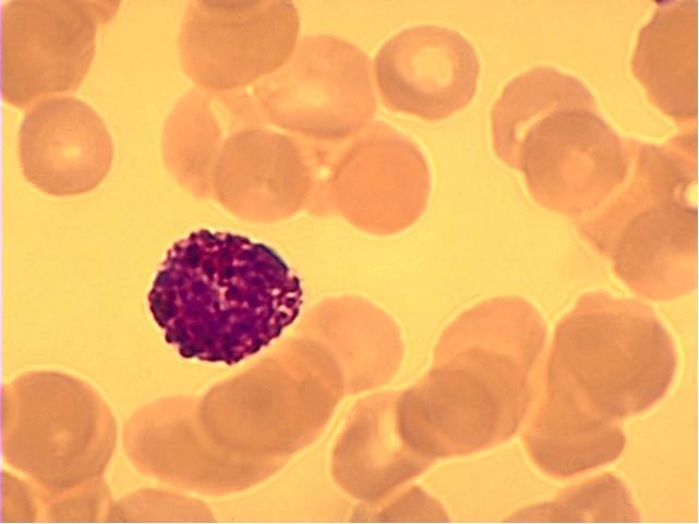 Lymphocytes Monocytes Neutrophil 25