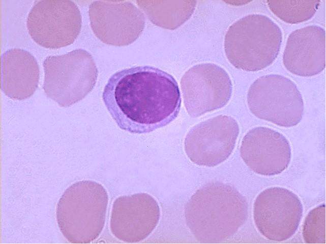 Lymphocyte Monocyte 29 30 WBC Circulation & Movement All can migrate out of bloodstream Only ~2% of population in circulating