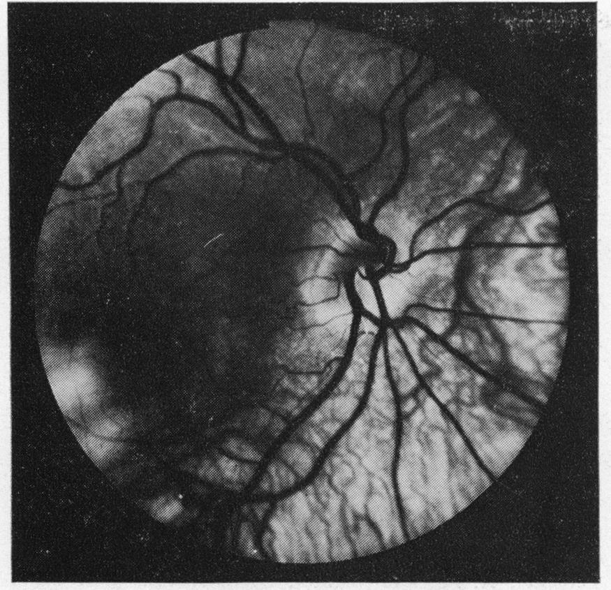 cross-section of the optic disc (Fig. 7).