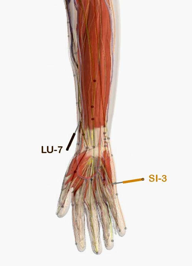 abductor pollicis longus tendons Indications include