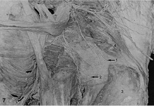 Posterior Hip Joint Innervation sciatic nerve piriformis medial branch of sciatic