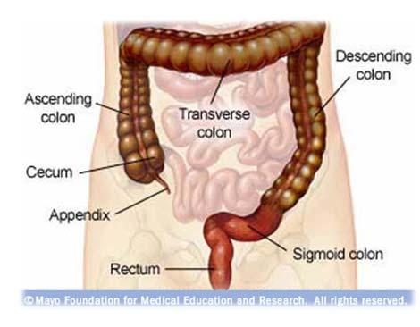 Most Common Causes of CPP Irritable Bowel Endometriosis Interstitial Cystitis