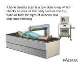 4. Follow your doctor s recommendations Talk to your doctor about bone health Have a bone density test and take medication when advised Lactose intolerance?