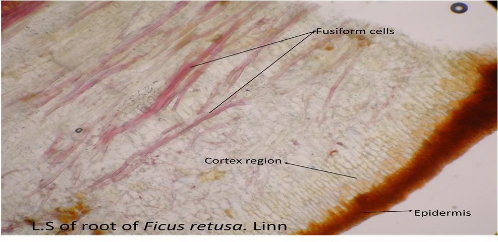 Journal of Medicinal Plants Studies Figure 2d: L.S of root of Ficus retusa showing epidermis, cortex region and fusiform cells. Figure 3a: Powdered sample of root of Ficus retusa.