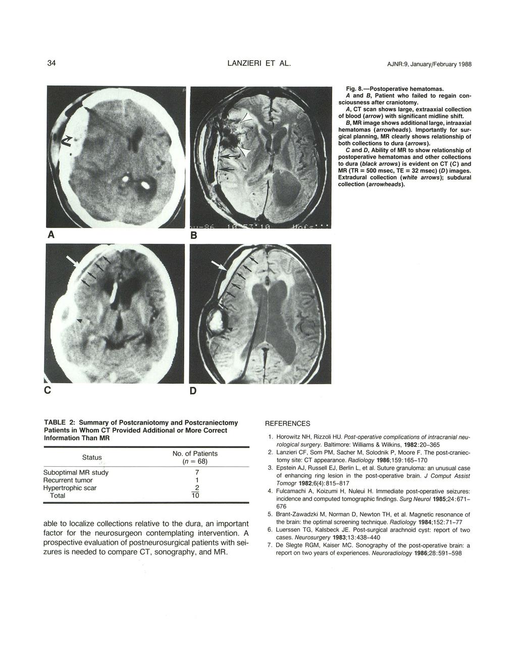 34 LANZIERI ET AL. AJNR:9, January/February 1988 Fig. 8.-Postoperative hematomas. A and B, Patient who failed to regain consciousness after craniotomy.